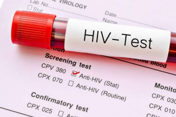 در چه سنی برای انجام آزمایش HIV اقدام کنیم؟