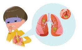 بایدها و نبایدهای پنومونی کودکان