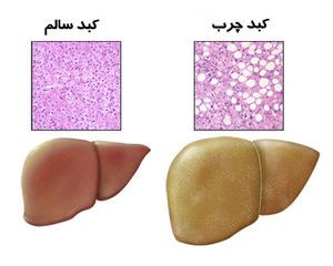 این میوه‌ کبد شما را از نو می‌سازد